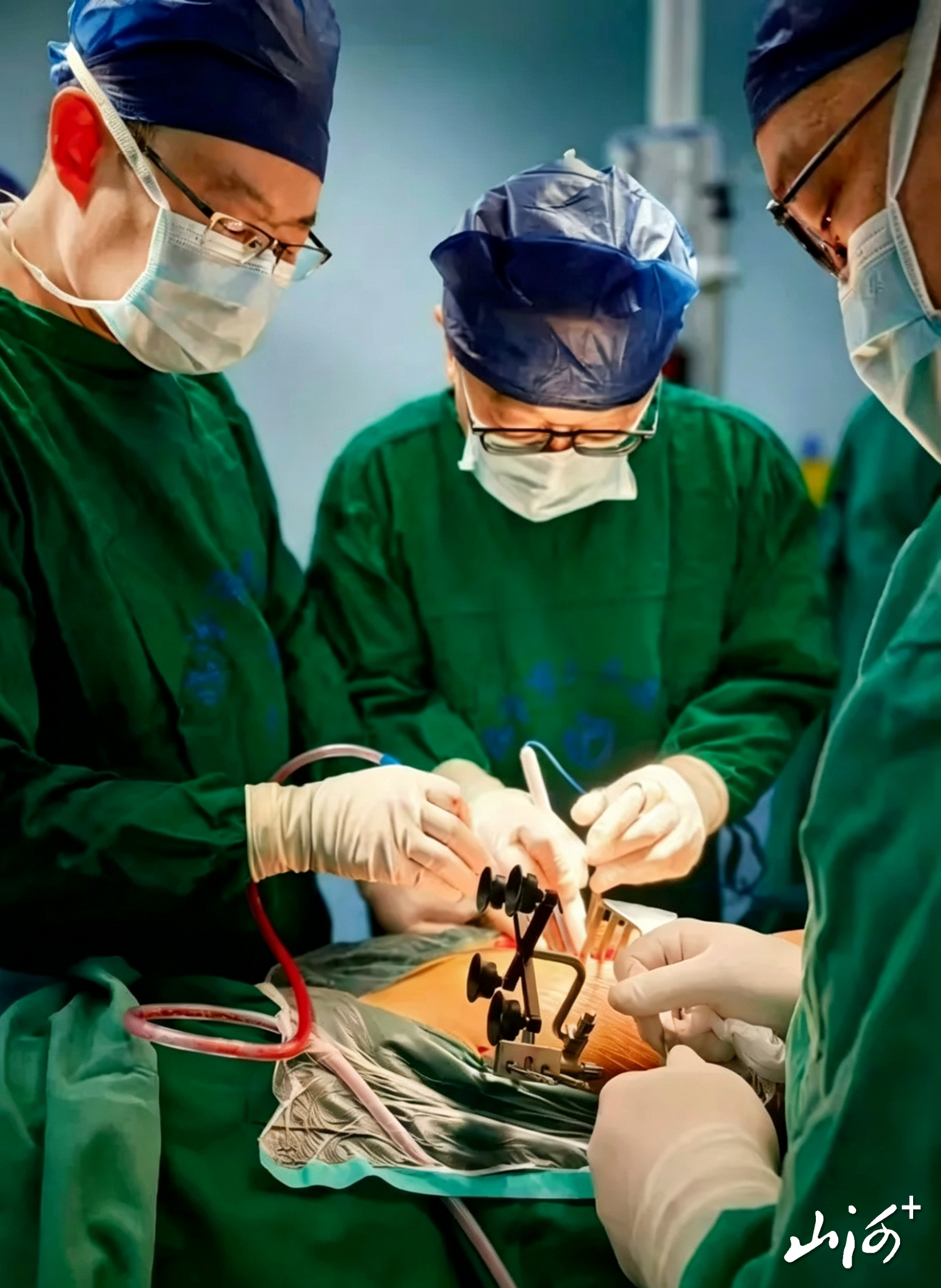 全髋关节置换手术中